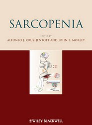 Sarcopenia