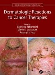 Dermatologic Reactions to Cancer Therapies