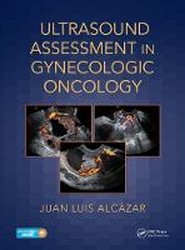 Ultrasound Assessment in Gynecologic Oncology