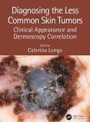 Diagnosing the Less Common Skin Tumors
