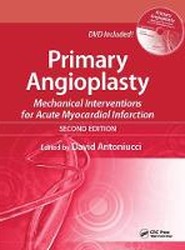 Primary Angioplasty