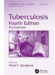 Tuberculosis