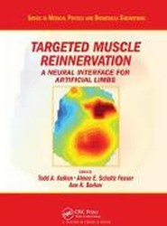 Targeted Muscle Reinnervation