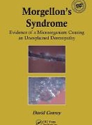 Morgellon's Syndrome