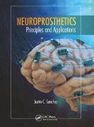 Neuroprosthetics
