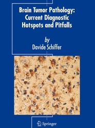 Brain Tumor Pathology: Current Diagnostic Hotspots and Pitfalls