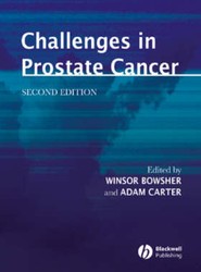 Challenges in Prostate Cancer 2e