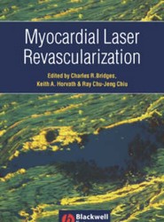 Myocardial Laser Revascularization