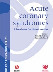 Acute coronary syndromes: A Handbook for Clinical Practice