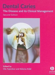 Dental Caries