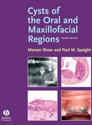 Cysts of the Oral and Maxillofacial Regions