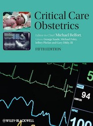 Critical Care Obstetrics