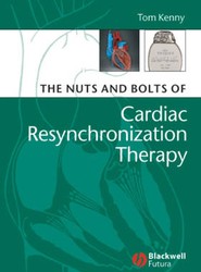 The Nuts and Bolts of Cardiac Resynchronization Therapy