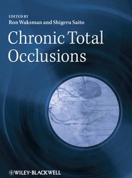 Chronic Total Occlusions