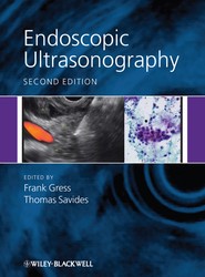 Endoscopic Ultrasonography