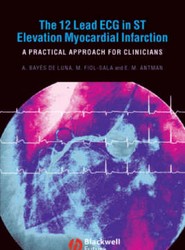 12-Lead ECG in ST Elevation Myocardial Infarction: A Practical Approcah for Clinicians