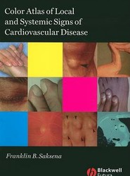 Colour Atlas of Local and Systemic Signs of Cardiovascular Disease