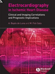 Electrocardiography in Ischemic Heart Disease