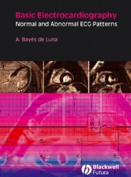 Basic Electrocardiography - Normal and Abnormal ECG Patterns
