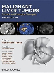 Malignant Liver Tumors - Current and Emerging Therapies 3e