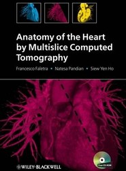 Anatomy of the Heart by Multislice Computed Tomography