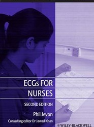ECGs for Nurses 2e