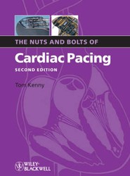 The Nuts and Bolts of Cardiac Pacing 2e