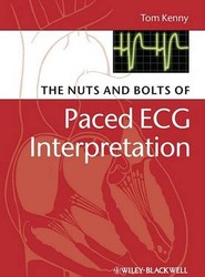 The Nuts and Bolts of Paced ECG Interpretation