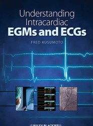 Understanding Intracardiac EGMs and ECGs