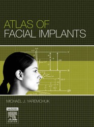 Atlas of Facial Implants