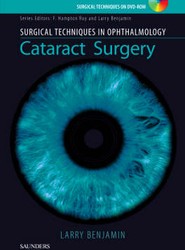 Surgical Techniques in Ophthalmology Series: Cataract Surgery
