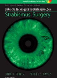 Surgical Techniques in Ophthalmology Series: Strabismus Surgery