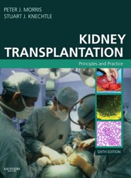 Kidney Transplantation
