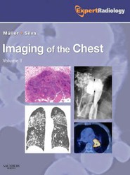 Imaging of the Chest, 2-Volume Set