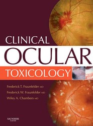 Clinical Ocular Toxicology