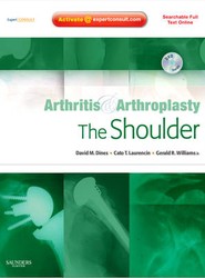 Arthritis and Arthroplasty: The Shoulder