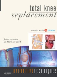 Operative Techniques: Total Knee Replacement