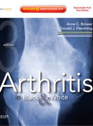 Arthritis in Black and White