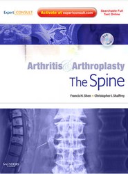 Arthritis and Arthroplasty: The Spine