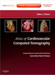 Atlas of Cardiovascular Computed Tomography: Expert Consult - Online and Print