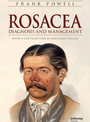 Rosacea