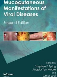 Mucocutaneous Manifestations of Viral Diseases