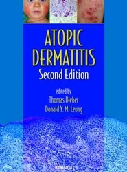 Atopic Dermatitis