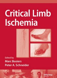 Critical Limb Ischemia