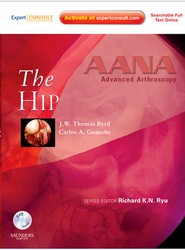 AANA Advanced Arthroscopy: The Hip