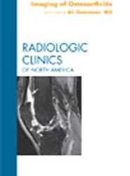 Imaging of Osteoarthritis, An Issue of Radiologic Clinics of North America: Volume 47-4