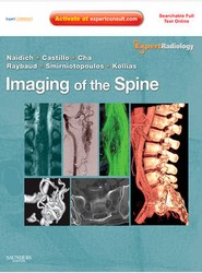 Imaging of the Spine