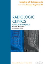 Imaging of Osteoporosis, An Issue of Radiologic Clinics of North America: Volume 48-3