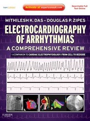 Electrocardiography of Arrhythmias: A Comprehensive Review