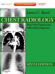 Chest Radiology